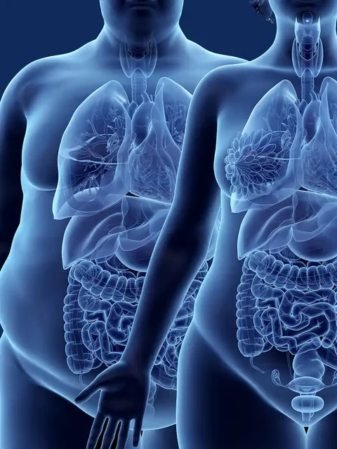 The Health Risks of Excess Body Fat cover