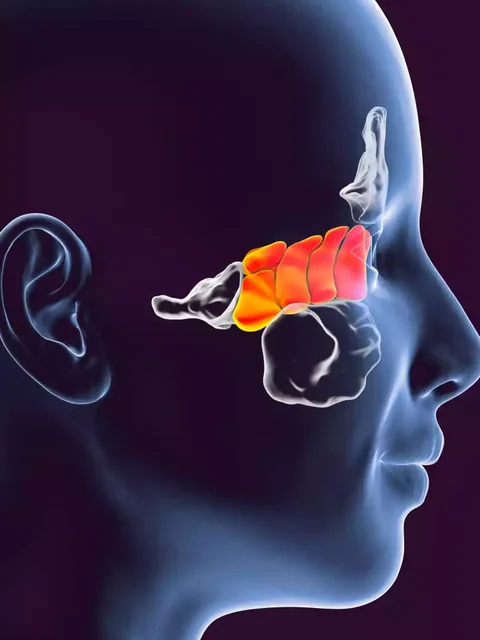 The Ultimate Guide to Sinus Infection cover