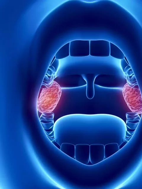 The Ultimate Guide to Tonsillitis cover